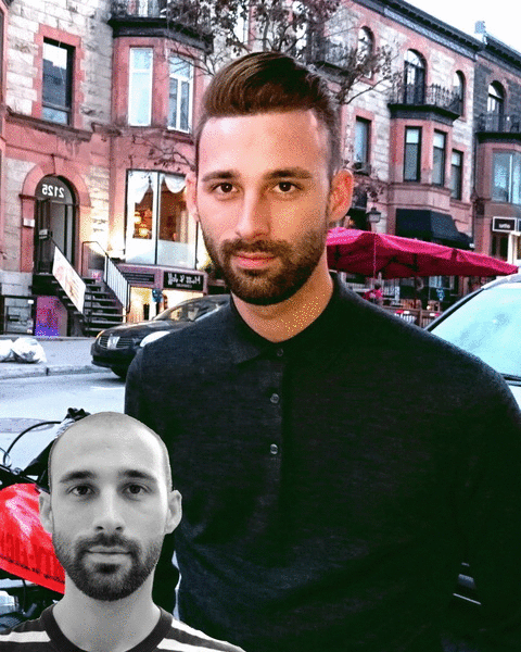 Top Qualiyy Hair Patches, Hair Patch Installation at The Hair Clinic Montreal