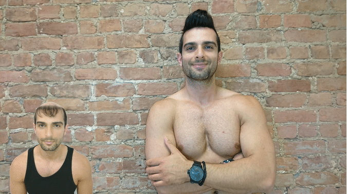 Hair Patch Systems at The Hair Clinic Montreal