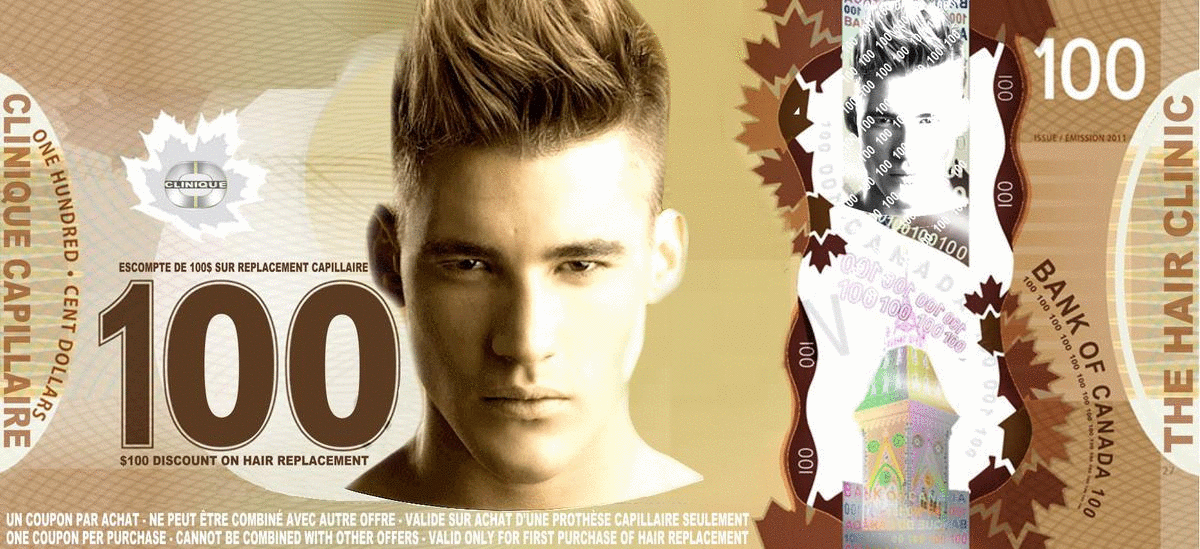 $100 Discount on Hair Patches & Hair Patch Systems at The Hair Clinic